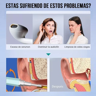 Foto 3 | Limpiador Oídos Cámara Quita Cerilla Inteligente Eo Safe Imports Esi-10367 Azul