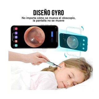 Foto 2 | Limpiador de Oídos con Cámara Quita Cerilla Inteligente Endoscopio Verde
