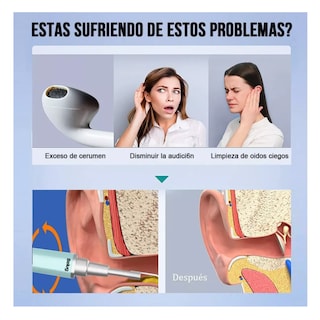 Foto 4 | Limpiador de Oídos con Cámara Quita Cerilla Inteligente Endoscopio Verde