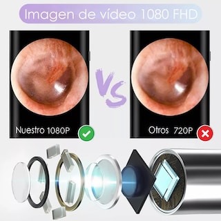 Foto 4 | Limpiador Oídos Cámara Quita Cerilla Inteligente Endoscopio Multicolor Belug