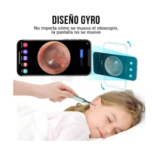 Foto 2 | Limpiador De Oídos Con Cámara, Quita Cerilla Inteligente Endoscopio Belug, Verde/plata