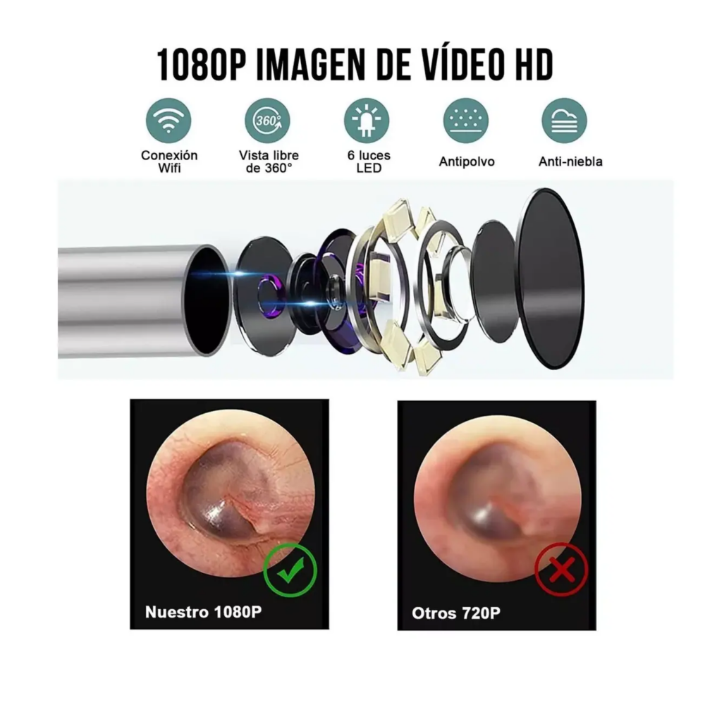 Foto 4 pulgar | Limpiador De Oídos Con Cámara, Quita Cerilla Inteligente Endoscopio Belug,  Verde/plata