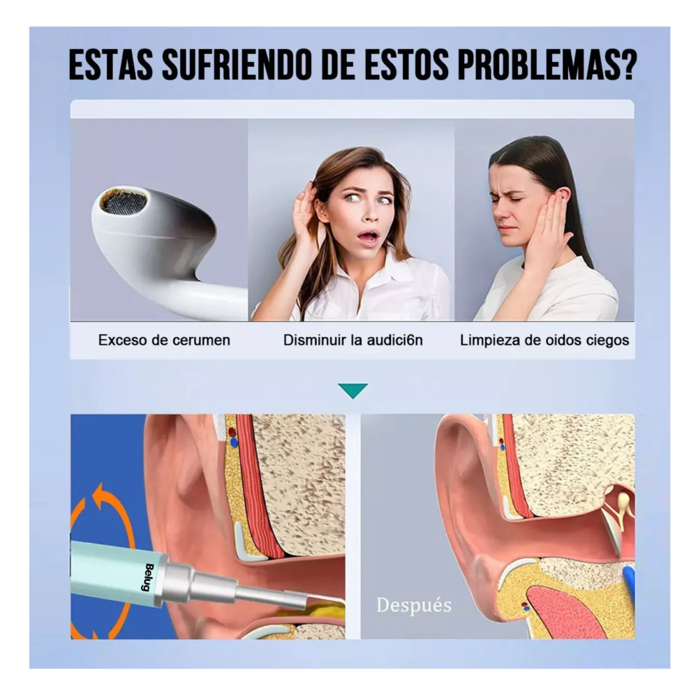 Foto 5 pulgar | Limpiador De Oídos Con Cámara, Quita Cerilla Inteligente Endoscopio Belug,  Verde/plata
