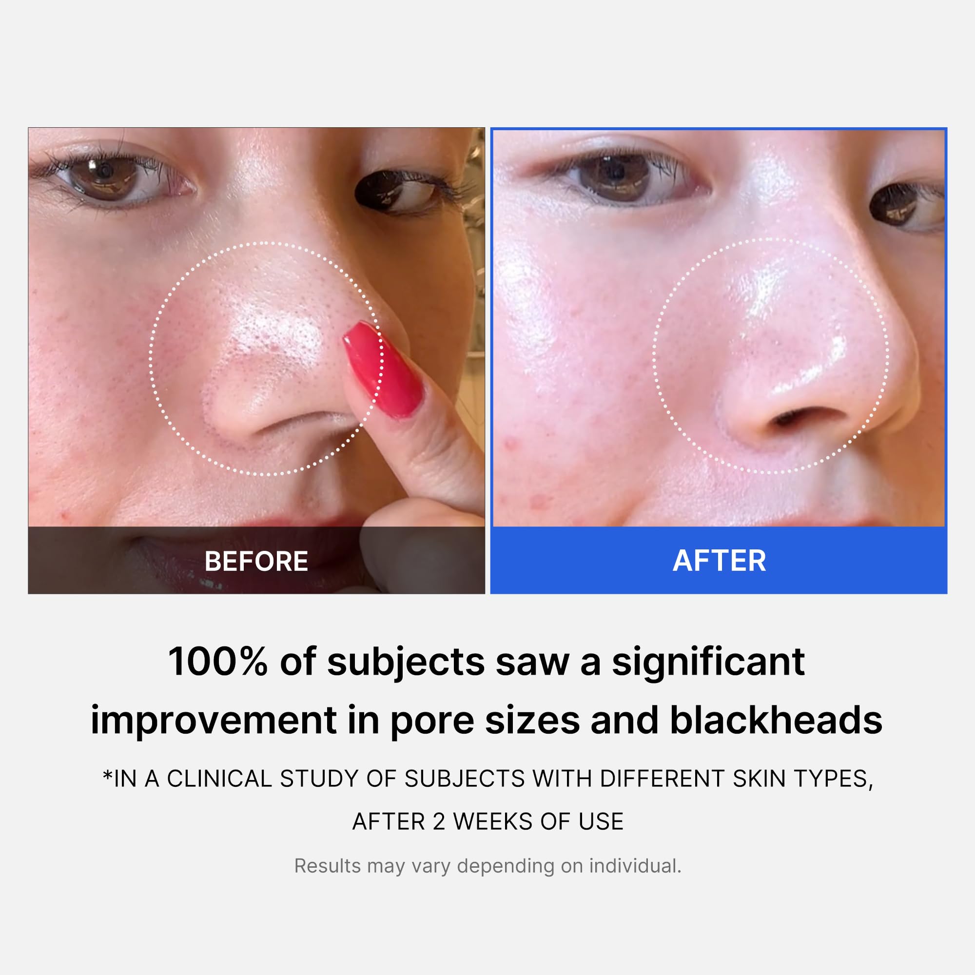 Foto 5 pulgar | Almohadillas De Tóner Facial Medicube Zero Pads 2.0 70 Almohadillas - Venta Internacional.