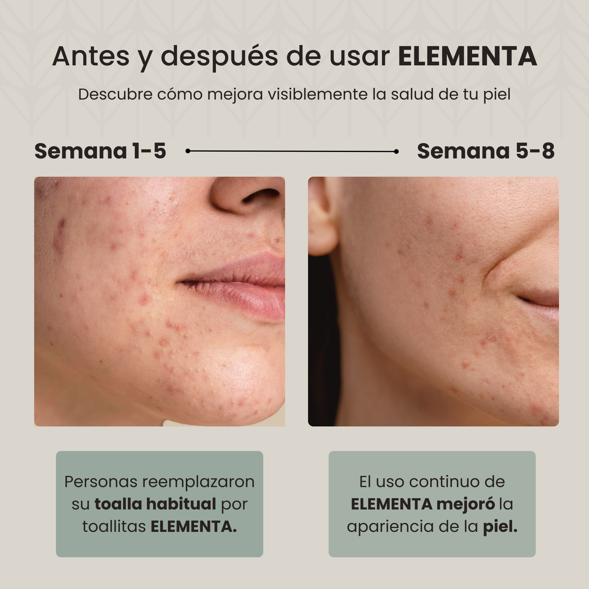 Foto 3 pulgar | Elementa Toallas Faciales Secas Extra Grandes Desechables (rostro Limpio Y Sin Bacterias), Hipoalergénicas, 100%