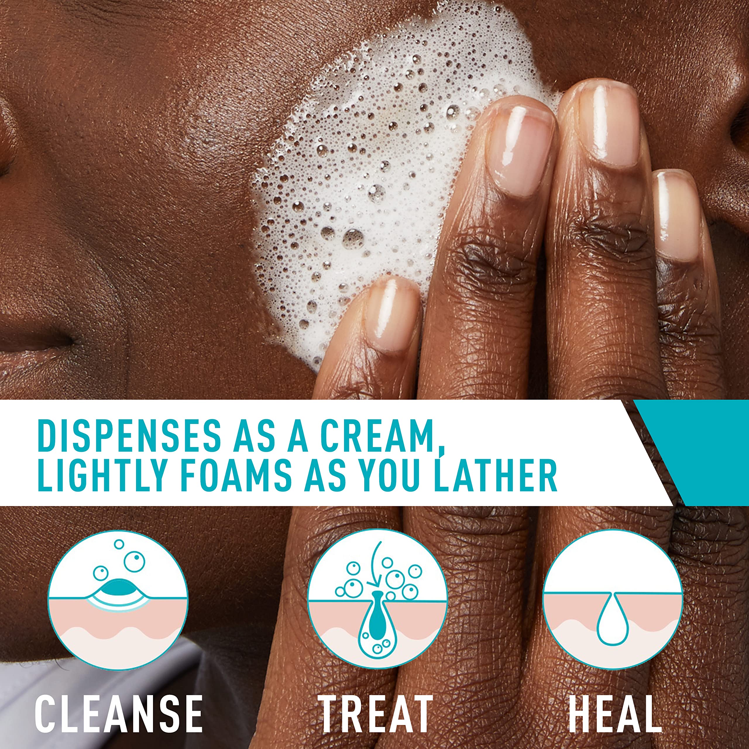 Foto 4 pulgar | Crema Limpiadora Espumosa Para Acné Face Wash Cerave, 150 Ml Con Peróxido De Benzoilo Al 4% - Venta Internacional.