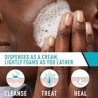 Foto 3 | Crema Limpiadora Espumosa Para Acné Face Wash Cerave, 150 Ml Con Peróxido De Benzoilo Al 4% - Venta Internacional.