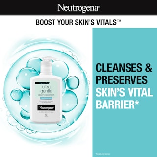 Foto 2 | Limpiador Neutrogena Ultra Suave, Espumoso, 170 Ml, Para Piel Sensible - Venta Internacional.
