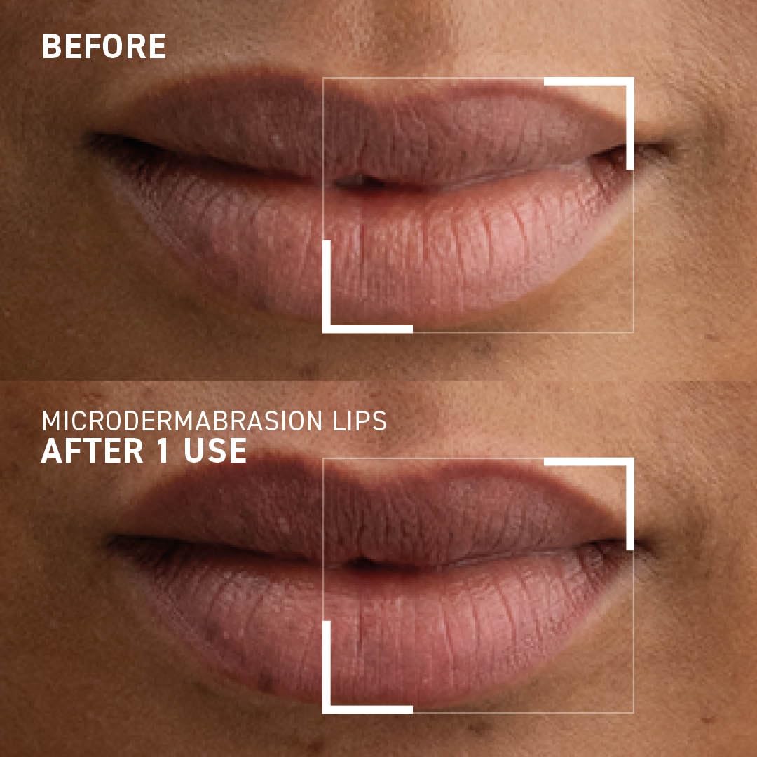 Foto 8 pulgar | Exfoliante Labial Dr. Brandt Microdermabrasion Suavizante 10 G - Venta Internacional.