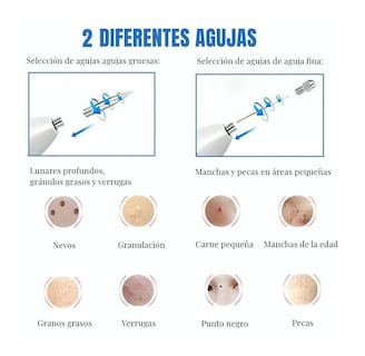 Foto 3 | Pluma Cauterizadora de Verrugas y Pecas Malubero color Blanco