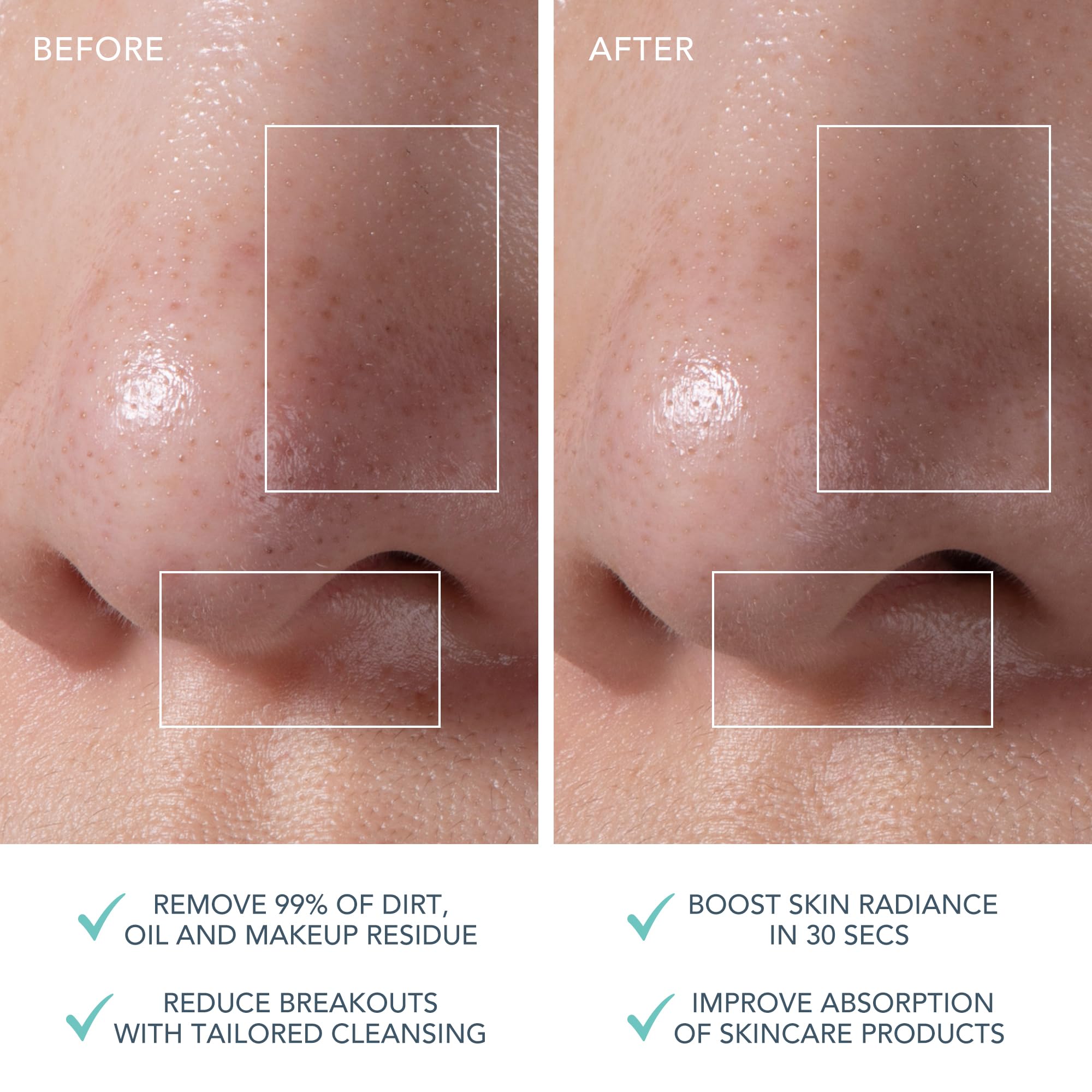 Foto 5 | Cepillo De Limpieza Facial De Silicona Foreo Luna Mini 3 Mint - Venta Internacional.