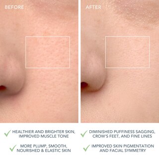 Foto 5 | Cepillo Limpiador Facial Foreo Luna 4 Masajeador Reafirmante Antienvejecimiento - Venta Internacional.