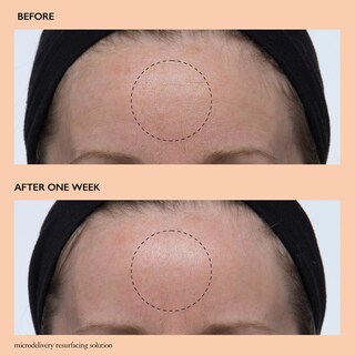 Foto 5 | Solución Rejuvenecedor Con Microentrega Skincare Philosophy, 150 Ml - Venta Internacional.