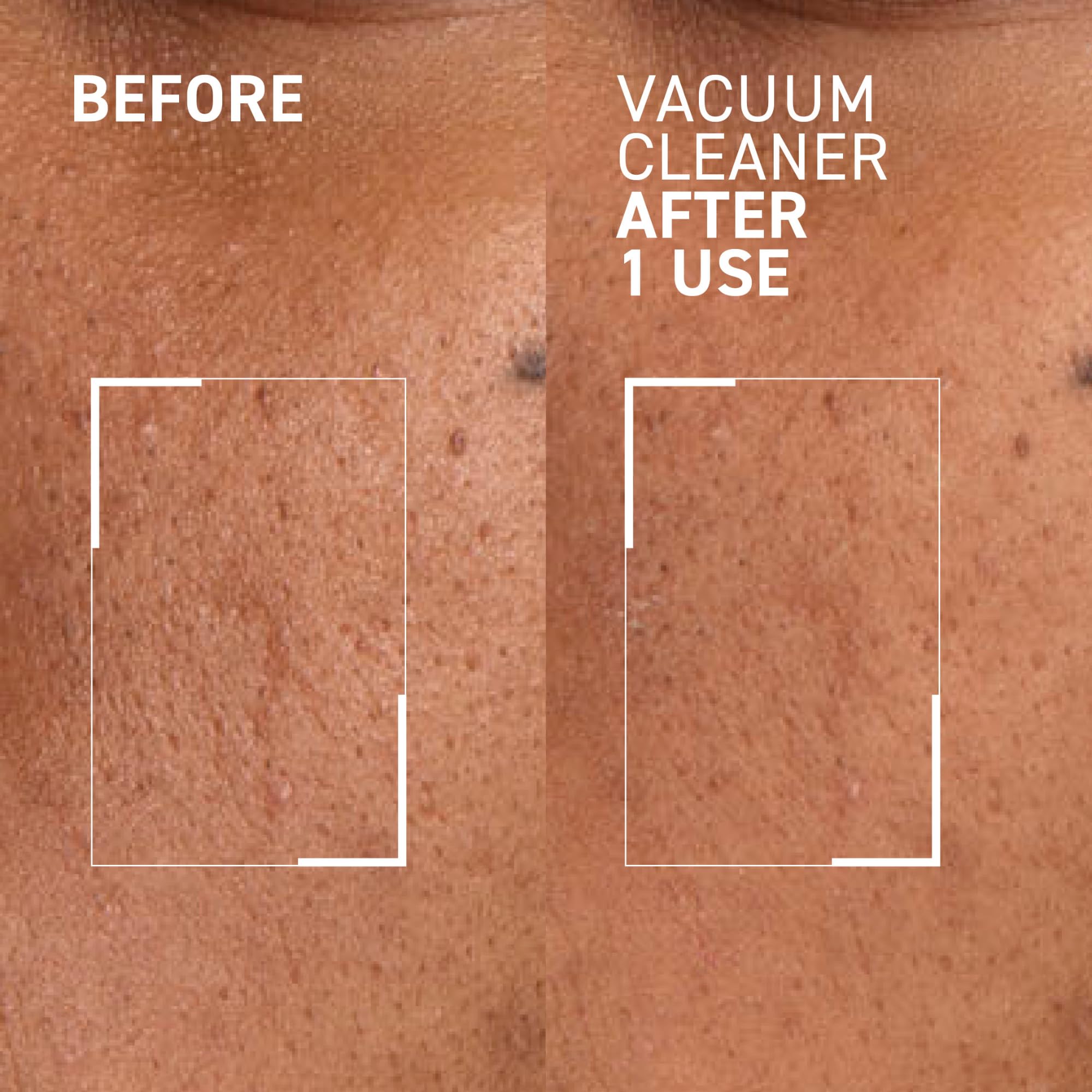 Foto 4 | Máscara Purificadora De Poros Dr. Brandt Pores No More Aspiradora - Venta Internacional.