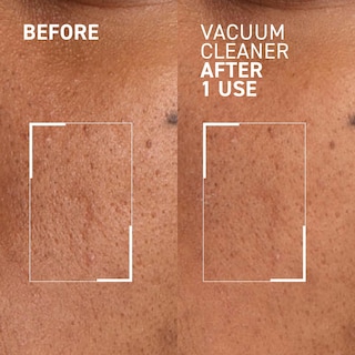 Foto 4 | Máscara Purificadora De Poros Dr. Brandt Pores No More Aspiradora - Venta Internacional.