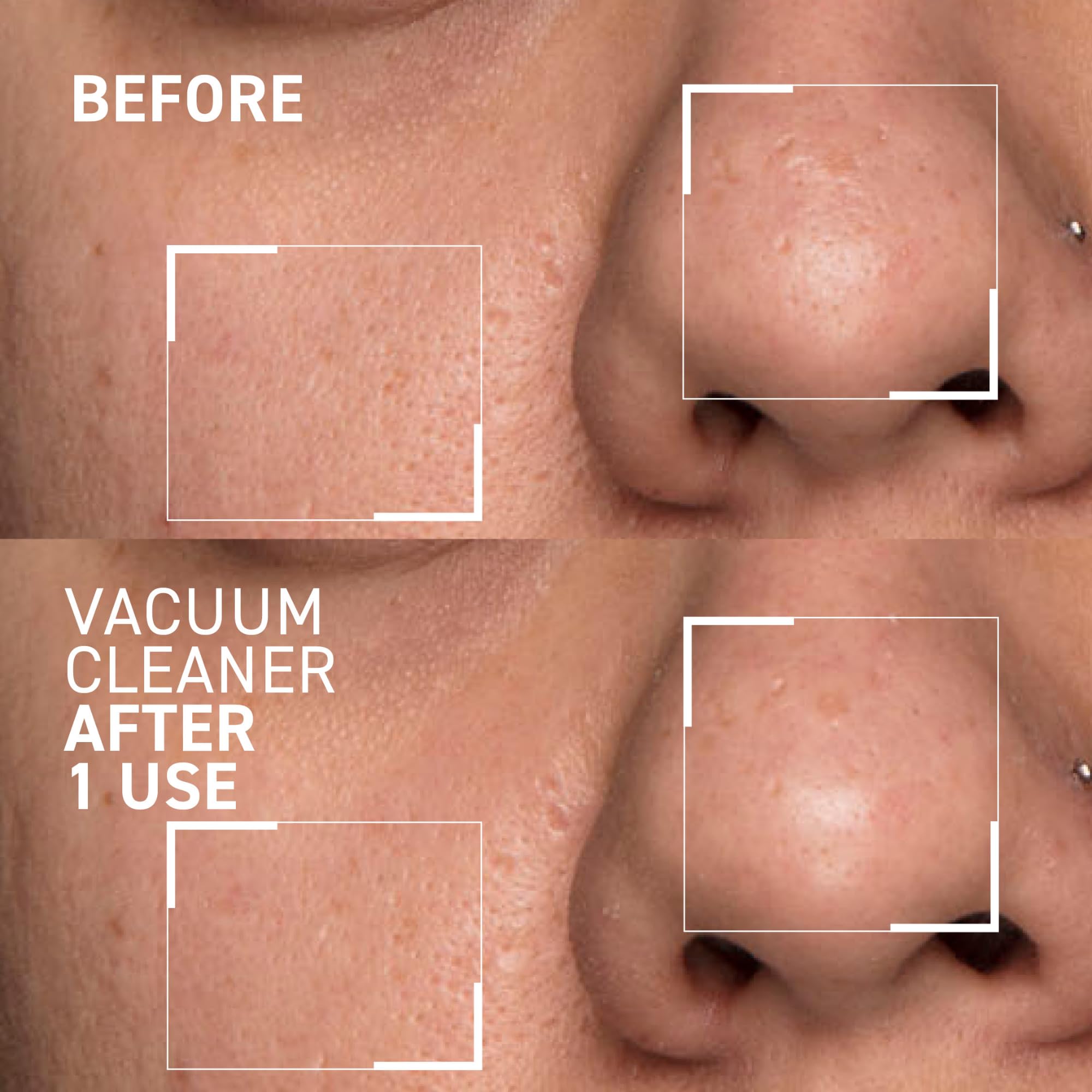 Foto 6 | Máscara Purificadora De Poros Dr. Brandt Pores No More Aspiradora - Venta Internacional.