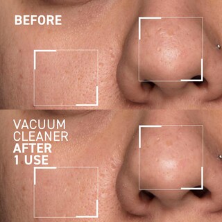 Foto 6 | Máscara Purificadora De Poros Dr. Brandt Pores No More Aspiradora - Venta Internacional.