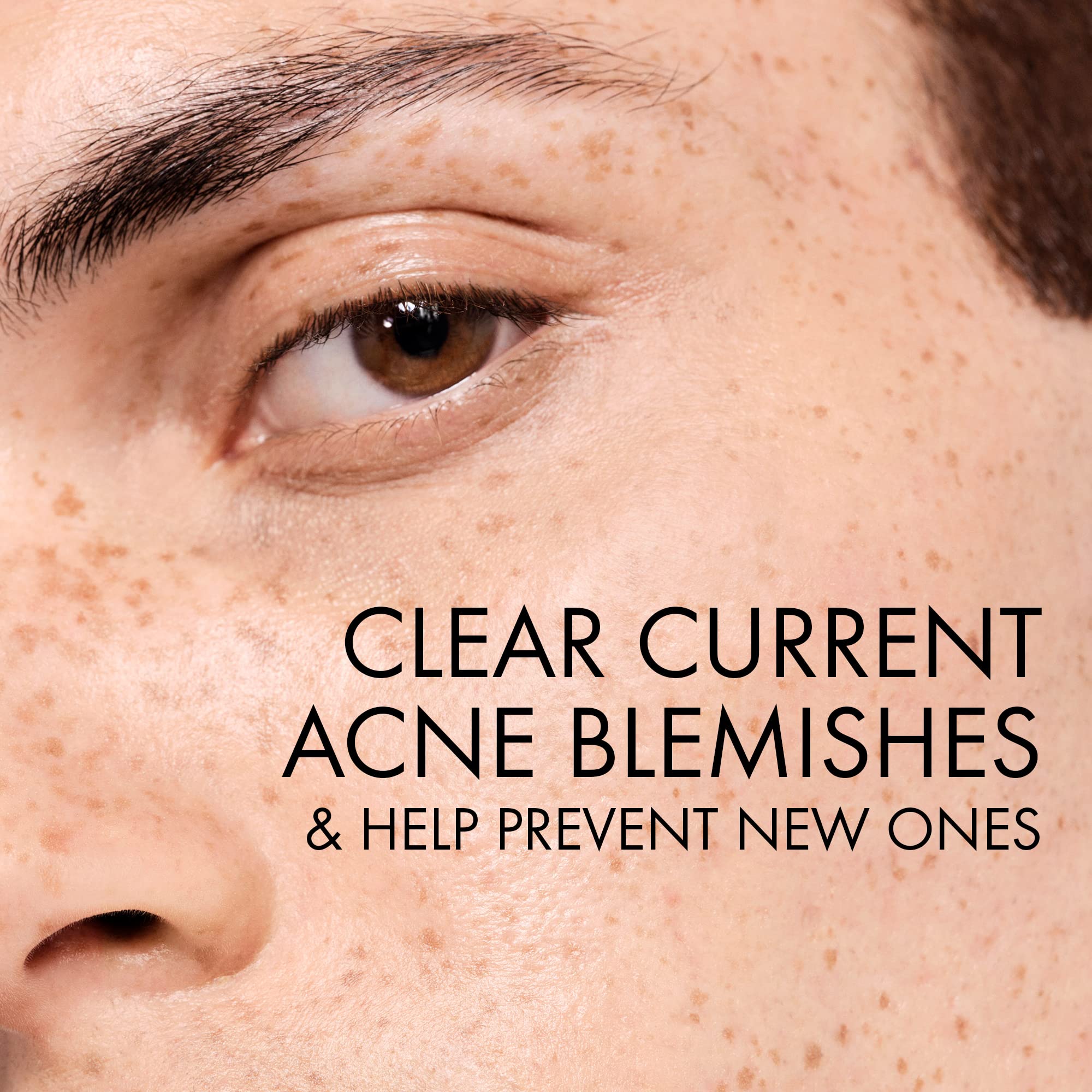Foto 3 pulgar | Gel De Lavado Facial Vichy Normaderm Daily Acne Con Ácido Salicílico Al 0,5% - Venta Internacional.