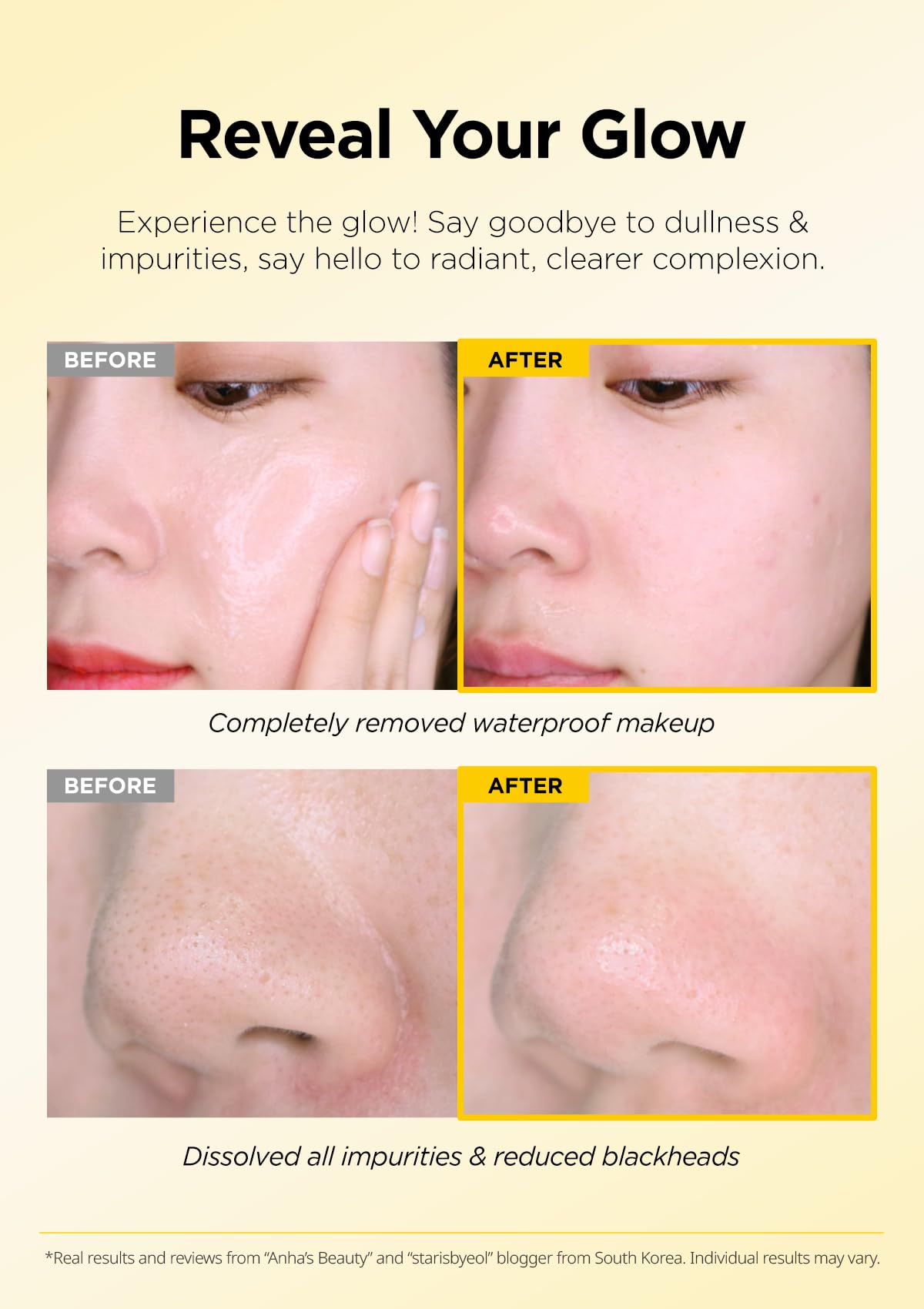 Foto 5 pulgar | Set Desmaquillante Hanskin Bha, Aceite Limpiador De Poros, 30 Ml, 2 Unidades - Venta Internacional.