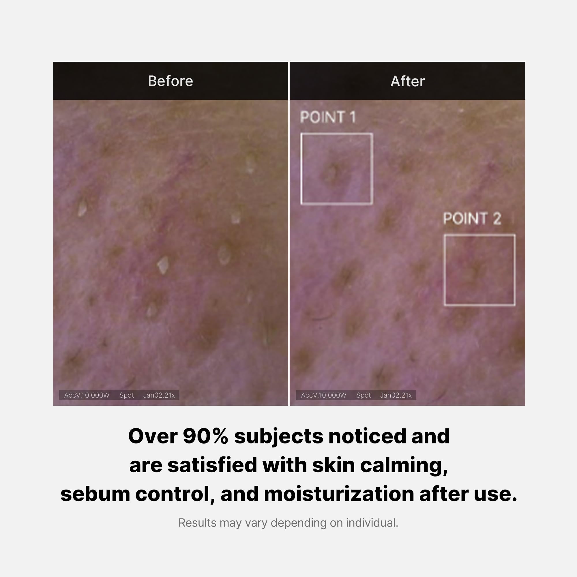 Foto 6 pulgar | Limpiador Facial Medicube Zero Foam Control Sebum Sensitive - Venta Internacional.