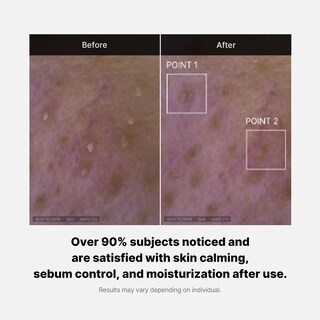 Foto 5 | Limpiador Facial Medicube Zero Foam Control Sebum Sensitive - Venta Internacional.