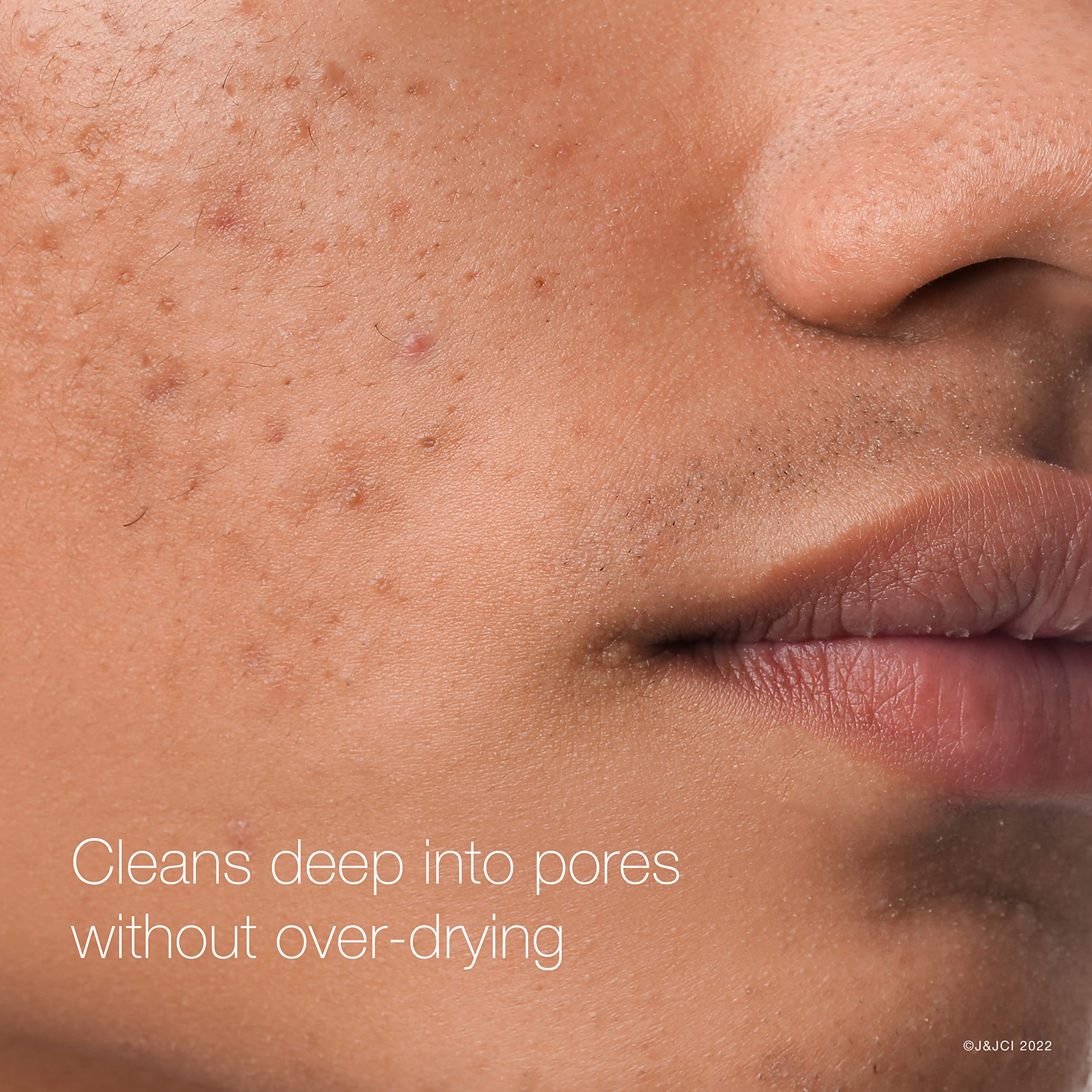 Foto 5 pulgar | Almohadillas Limpiadoras Faciales Neutrogena Rapid Clear Con Ácido Salicílico Al 2% - Venta Internacional.