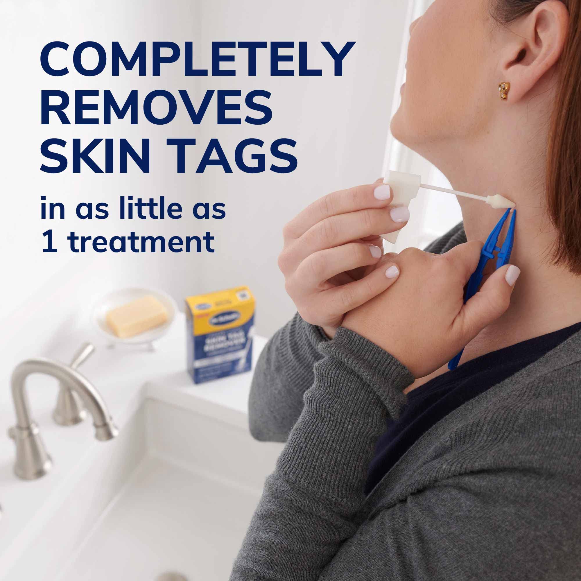 Foto 4 | Eliminador De Marcas Cutáneas Dr. Scholl's Freeze Away 8 Tratamientos - Venta Internacional.