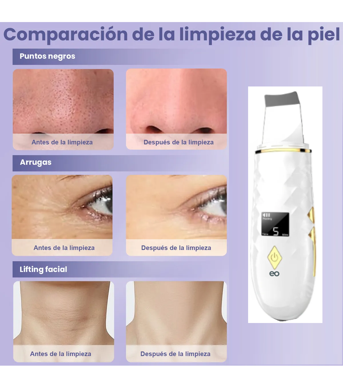 Foto 2 | Limpiador Ultrasónico Con 4 Modos Eliminación De Puntos Negros Y Limpieza Eo Safe Imports Esi-19019 Blanco