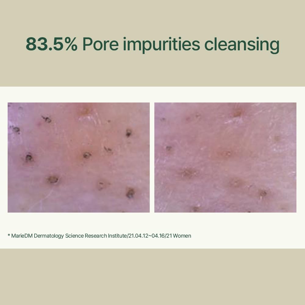 Foto 6 pulgar | Limpiador Pyunkang Yul Calming De Bajo Ph Con Árbol De Té, 150 Ml - Venta Internacional.