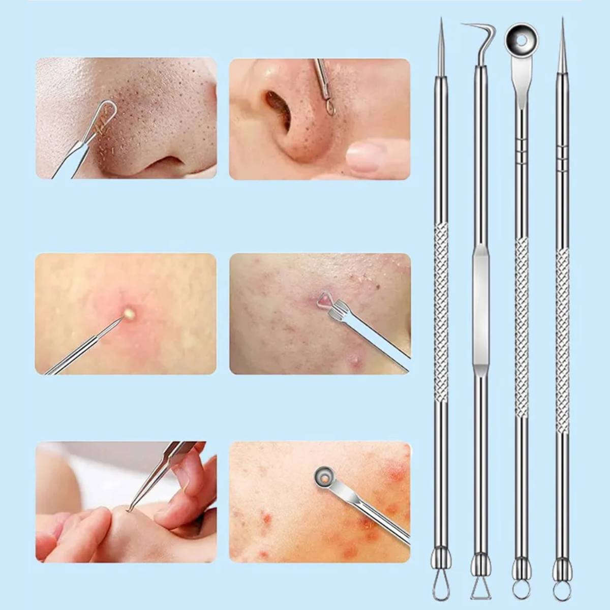 Foto 4 pulgar | Set de 3 Kits para Acne 4 Piezas c/u