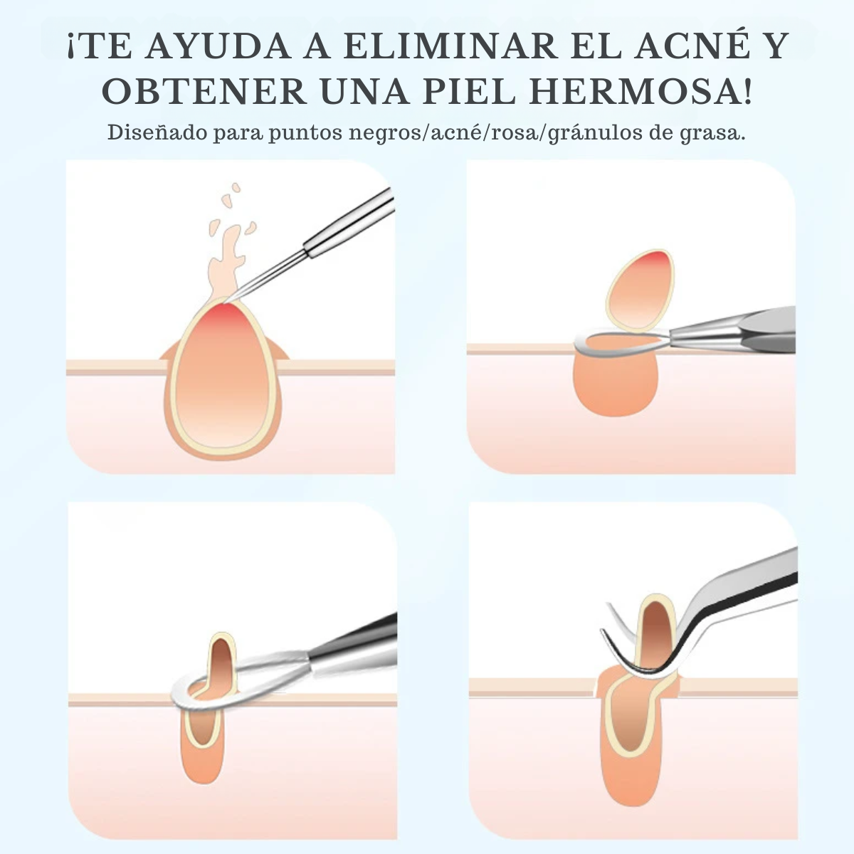 Foto 6 pulgar | Set de 3 Kits para Acne 4 Piezas c/u