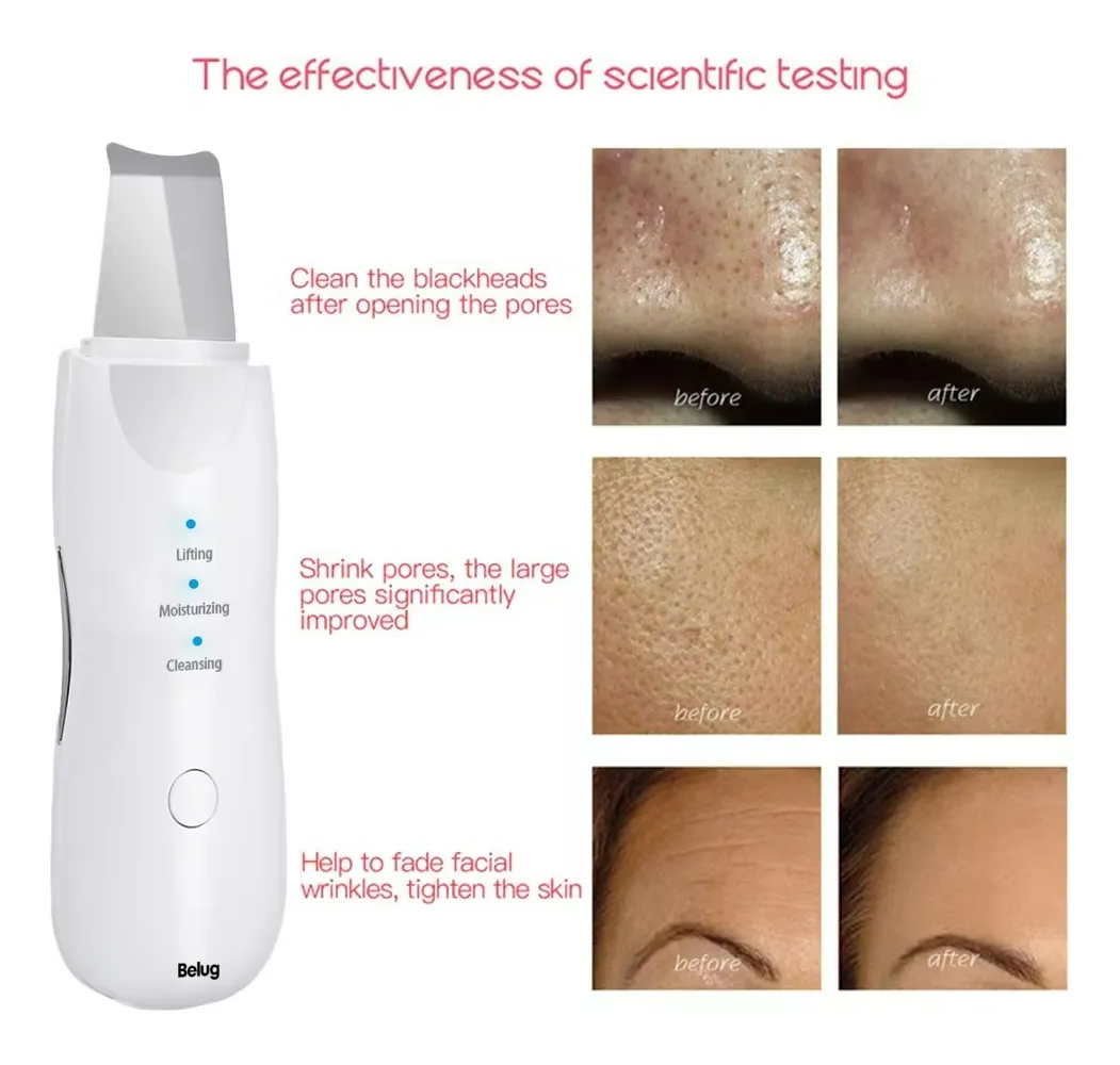 Foto 3 pulgar | Limpiador Facial Ultrasonico Belug Skin Scrubber Exfoliador Piel Blanco
