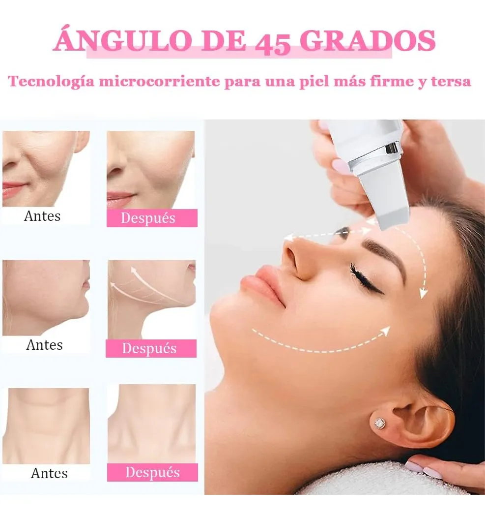 Foto 4 | Limpiador Facial Ultrasonico Belug Skin Scrubber Exfoliador Piel Blanco