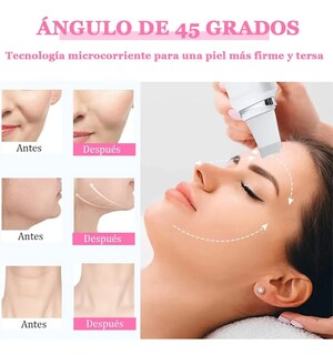 Foto 4 | Limpiador Facial Ultrasonico Belug Skin Scrubber Exfoliador Piel Blanco