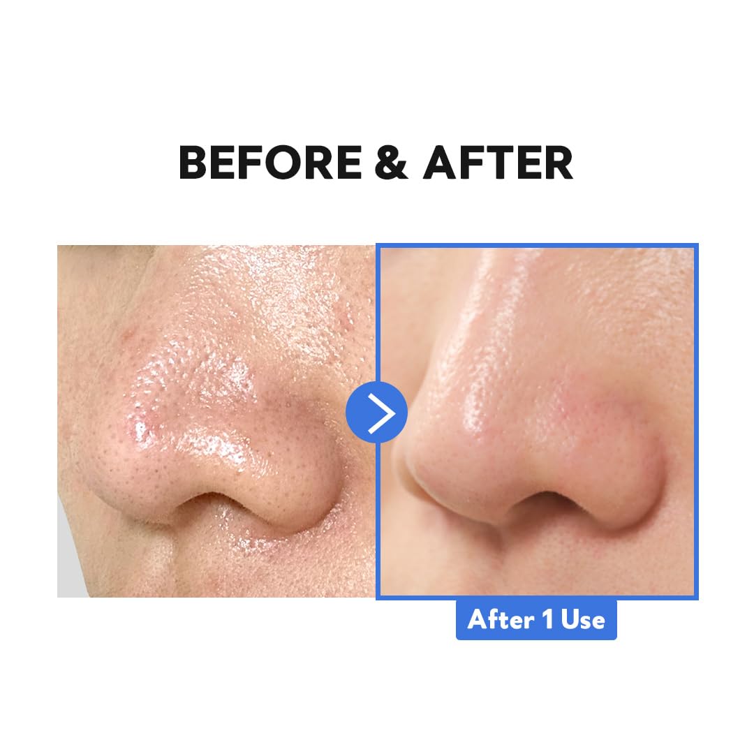 Foto 4 | Bálsamo Limpiador Tirtir Hydro Boost Enzyme, 50 Ml, Paquete De 1 - Venta Internacional.