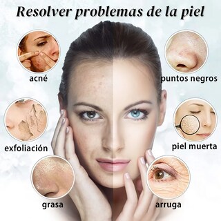 Foto 2 | Limpiador Ultrasónico Belug Facial Skin Blanco