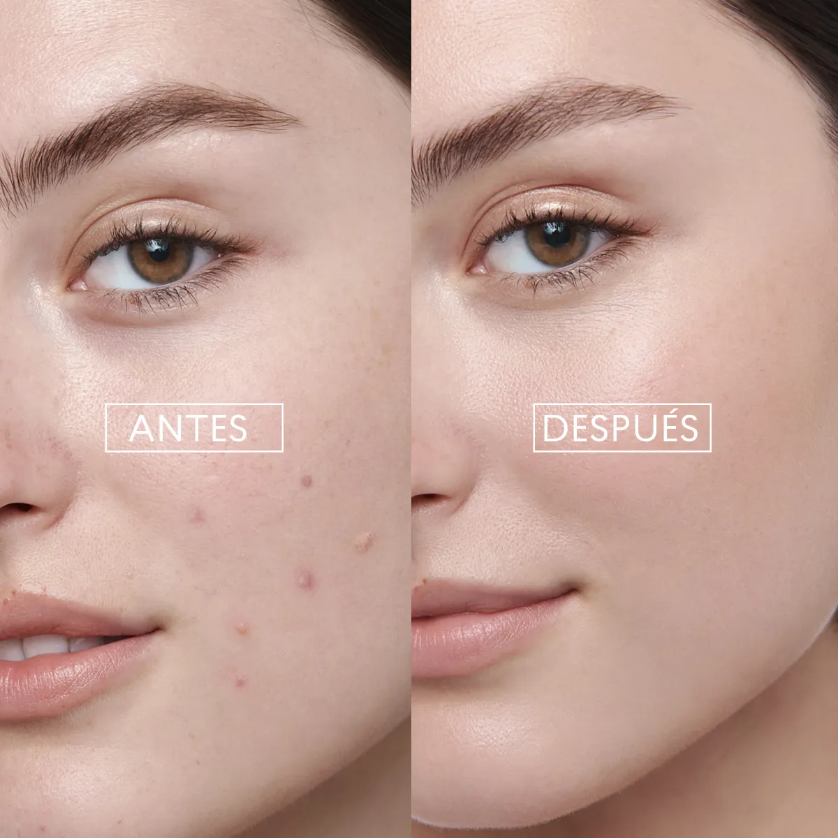 Foto 4 pulgar | Corrector Localizado Bye Bye Granitos Skin First Cyzone 15g