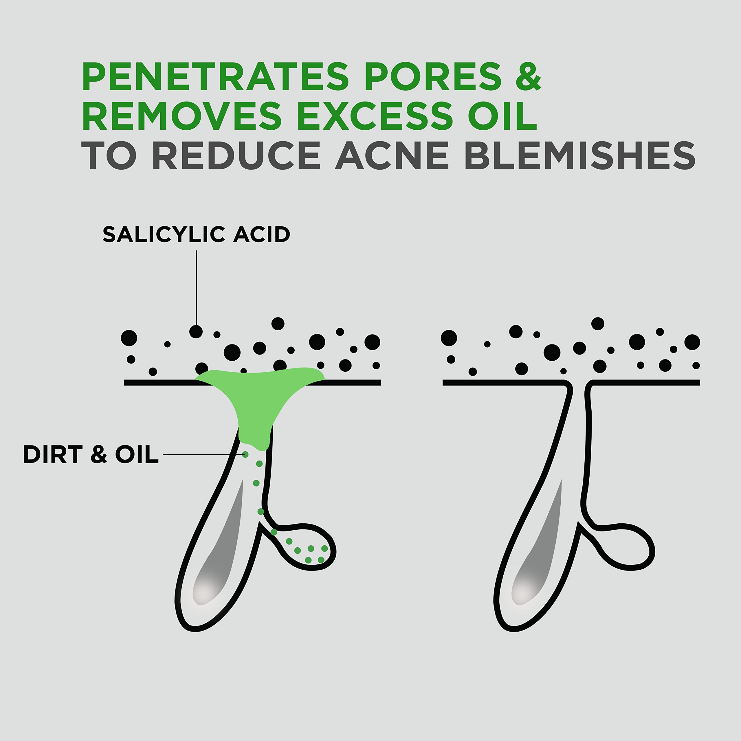 Foto 5 pulgar | Limpiador Dove Men + Care Advanced Care Acne Clear, 500 Ml, Paquete De 3 - Venta Internacional.