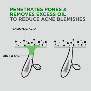 Foto 4 | Limpiador Dove Men + Care Advanced Care Acne Clear, 500 Ml, Paquete De 3 - Venta Internacional.