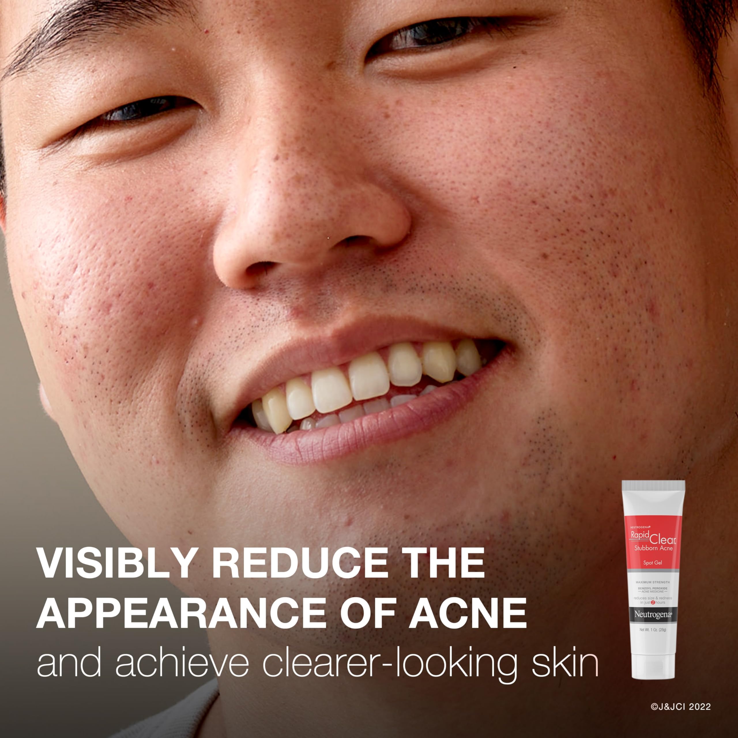 Foto 4 pulgar | Gel Neutrogena Rapid Clear Para Tratar Las Manchas Del Acné, 30 Ml, 10% Bp - Venta Internacional.