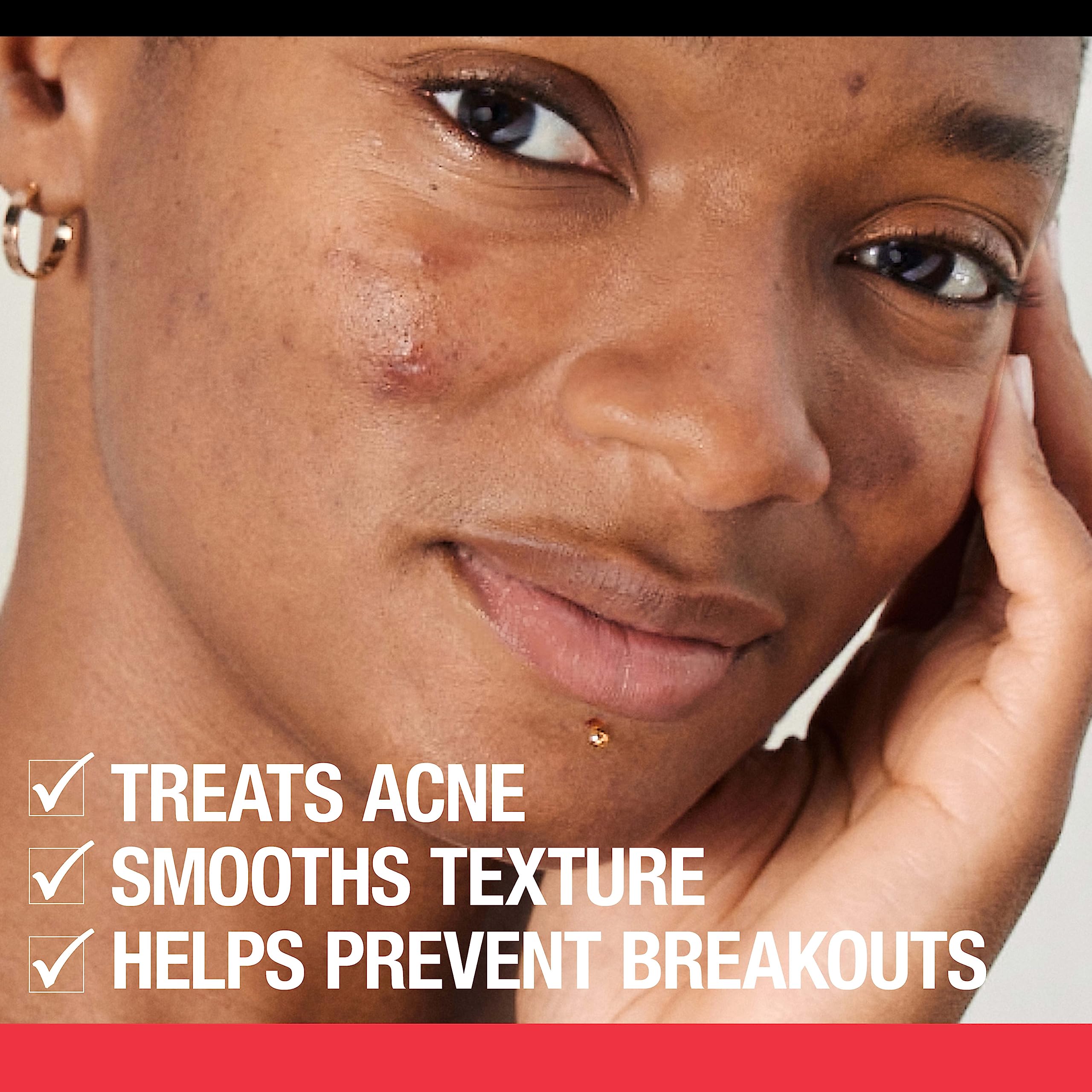 Foto 6 pulgar | Limpiador Facial Neutrogena Stubborn Texture Con Ácido Salicílico 180 Ml - Venta Internacional.