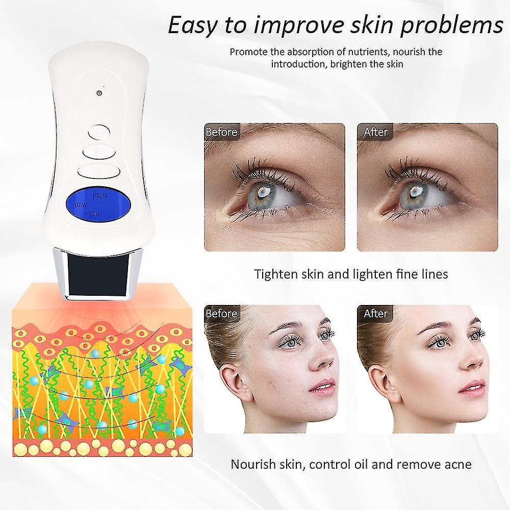 Foto 4 | Limpiadores Faciales Huoguo Dispositivo De Belleza Eléctrico Mini Usb Lcd - Venta Internacional.