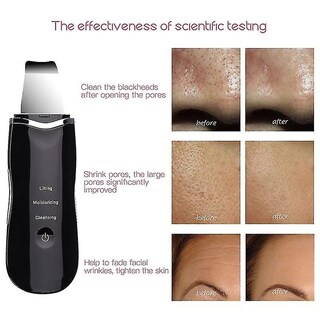 Foto 1 | Limpiadores Faciales Exfoliante Ultrasónico De Piel Exfoliación Profunda - Venta Internacional.