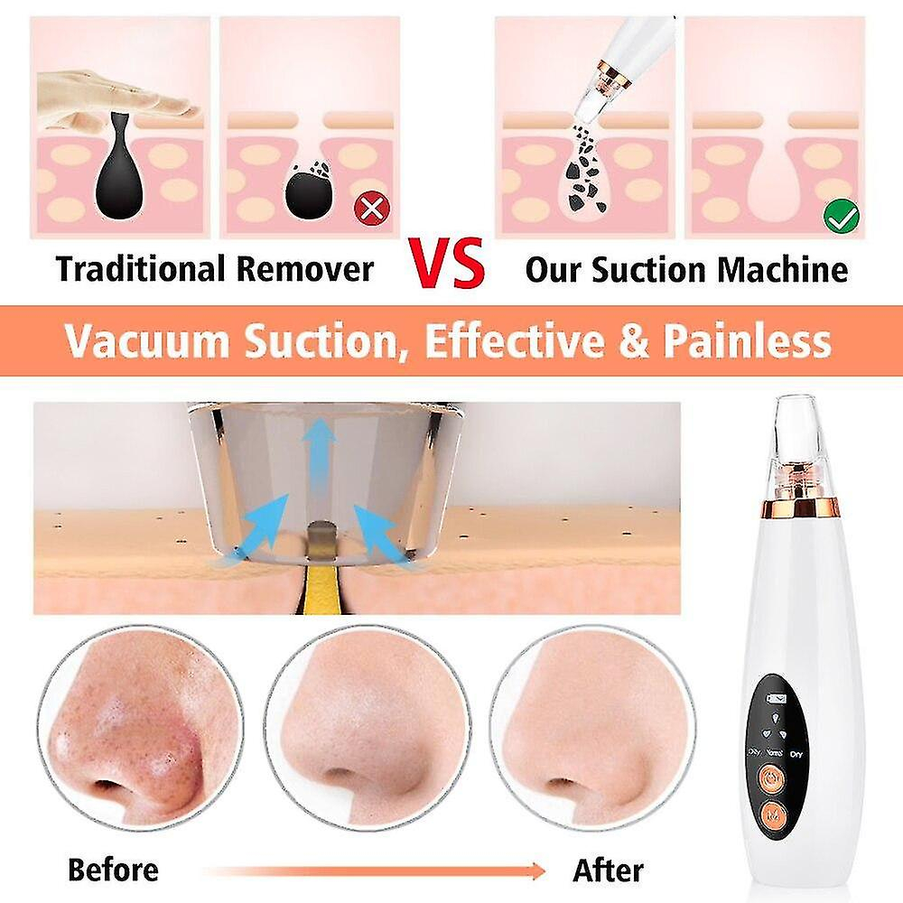 Foto 4 | Limpiador Facial Usb  Eliminador De Puntos Negros  Aspiradora De Poros  Cuidado De La Piel - Venta Internacional.