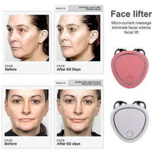 Foto 4 | Limpiadores Faciales Ems Facial Bear Microcurrent Face Lift Mach - Venta Internacional.