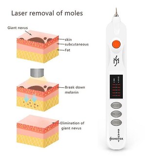 Foto 3 | Limpiador Facial Con Bolígrafo Eliminador De Manchas Huoguo Elimina Arrugas - Venta Internacional.