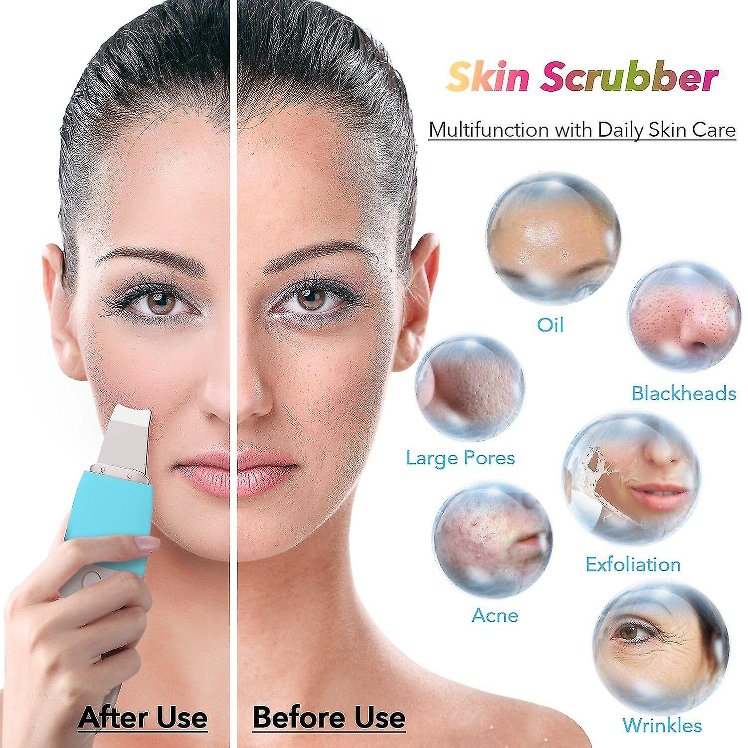 Foto 5 pulgar | Limpiadores Faciales  Espátula Facial Vibratoria  Eliminador De Puntos Negros - Venta Internacional.