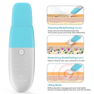 Foto 5 | Limpiadores Faciales Espátula Facial Vibratoria Eliminador De Puntos Negros - Venta Internacional.