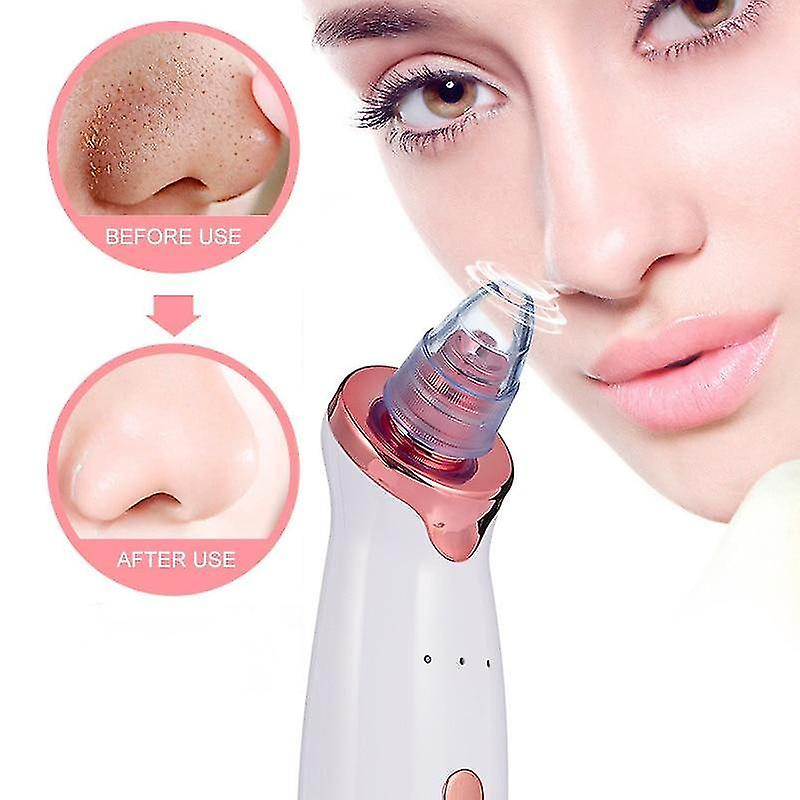 Foto 3 pulgar | Limpiadores Faciales  Eliminadores De Puntos Negros  Aspiradora Y Belleza - Venta Internacional.