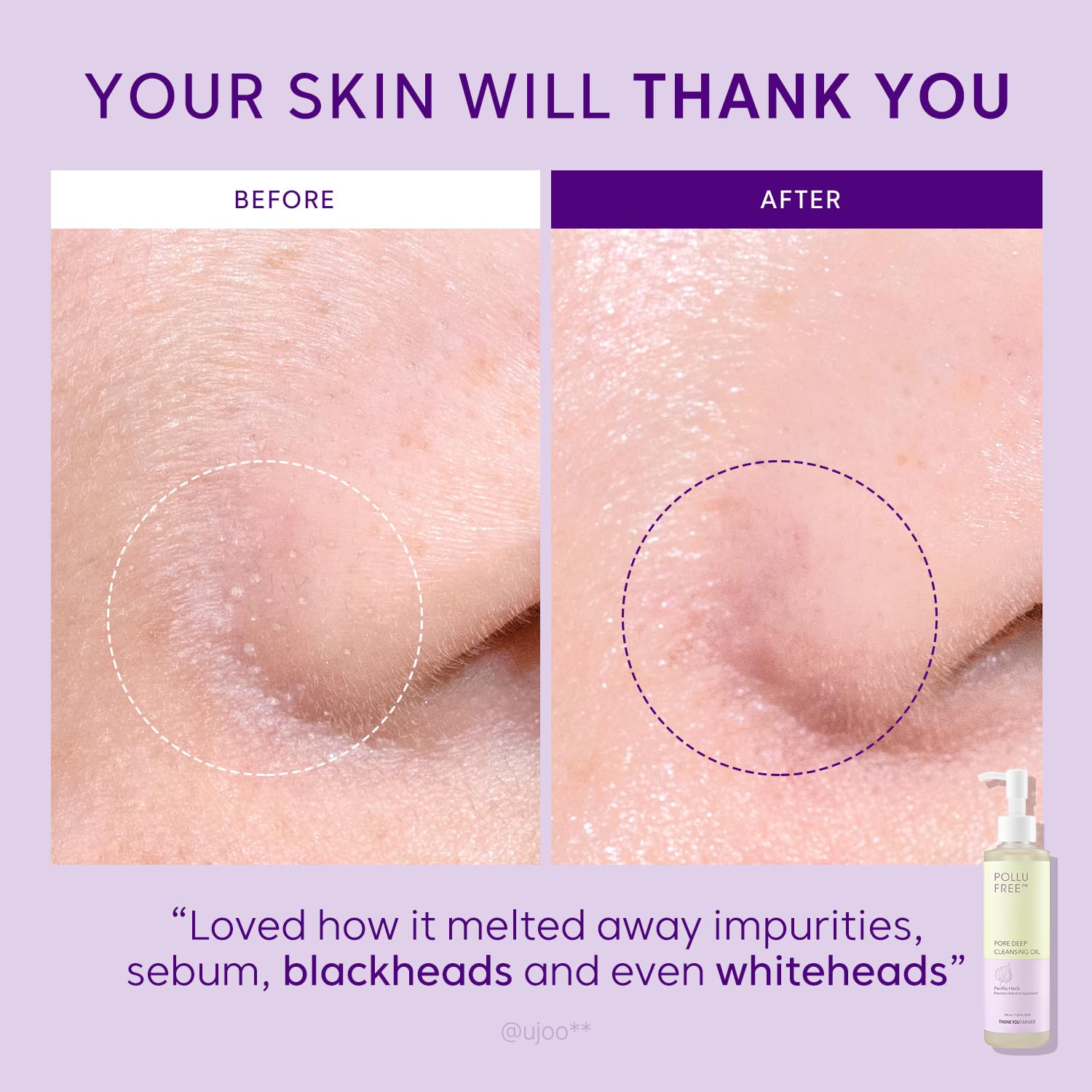 Foto 5 pulgar | Aceite Limpiador Thankyou Farmer Pollufree Blackhead Pore 200 Ml - Venta Internacional.
